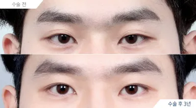 Before & After