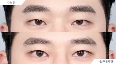 Before & After