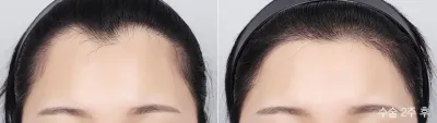 Before & After