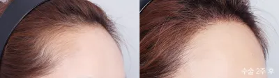 Before & After