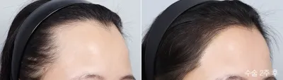 Before & After