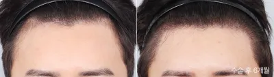 Before & After