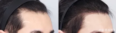 Before & After