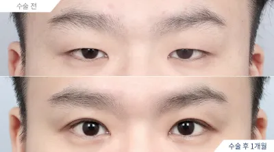 Before & After