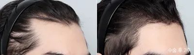 Before & After