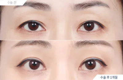 Before & After
