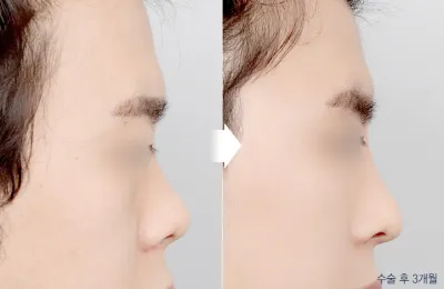Before & After