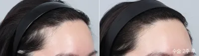 Before & After