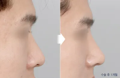 Before & After