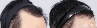 Before & After