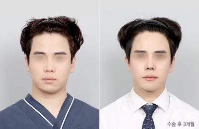 Before & After