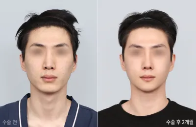 Before & After
