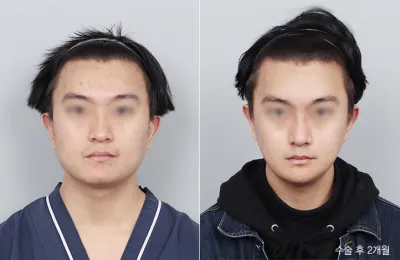 Before & After