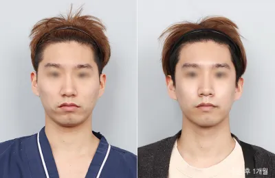 Before & After