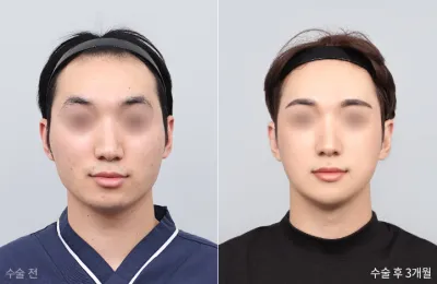 Before & After