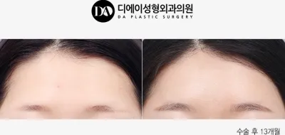 Before & After