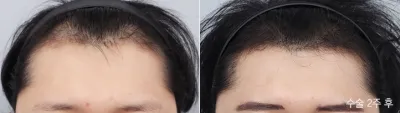Before & After