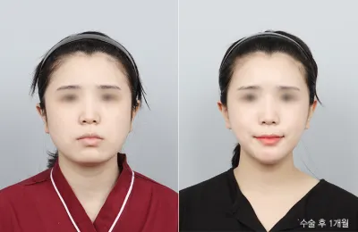 Before & After