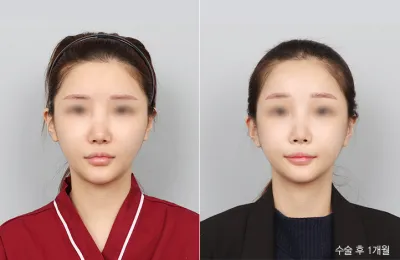 Before & After