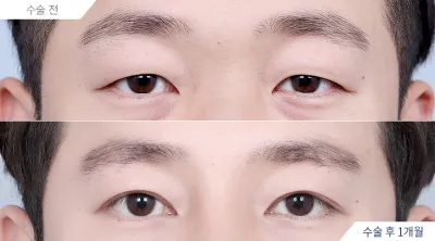 Before & After