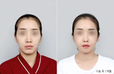 Before & After