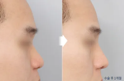 Before & After