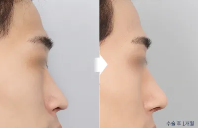 Before & After