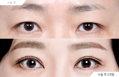Before & After