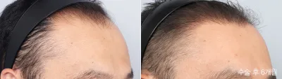 Before & After