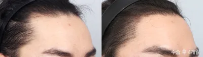 Before & After