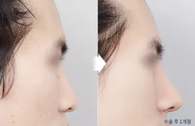 Before & After