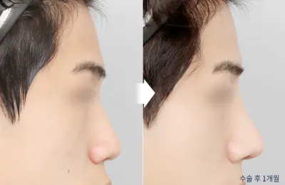 Before & After