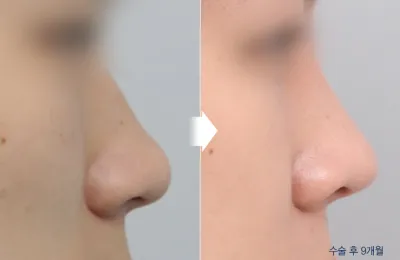Before & After