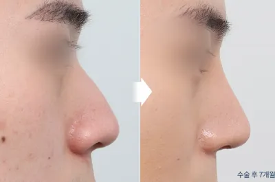 Before & After