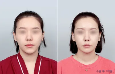 Before & After