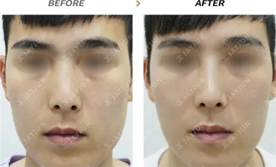Before & After