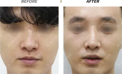 Before & After