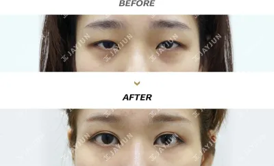 Before & After