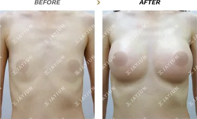 Before & After