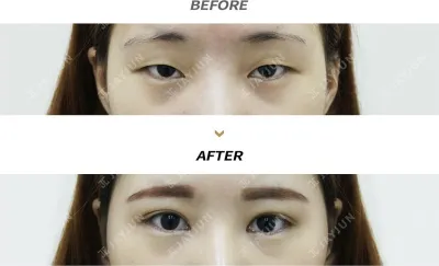 Before & After