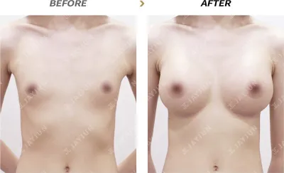 Before & After