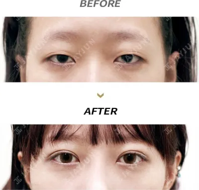 Before & After