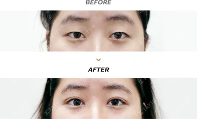 Before & After