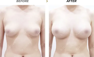 Before & After
