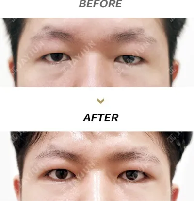 Before & After