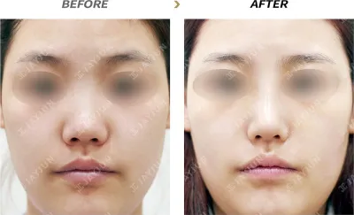 Before & After