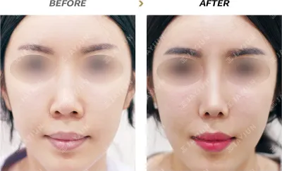 Before & After