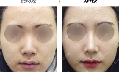 Before & After