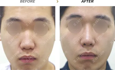 Before & After