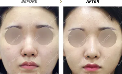 Before & After